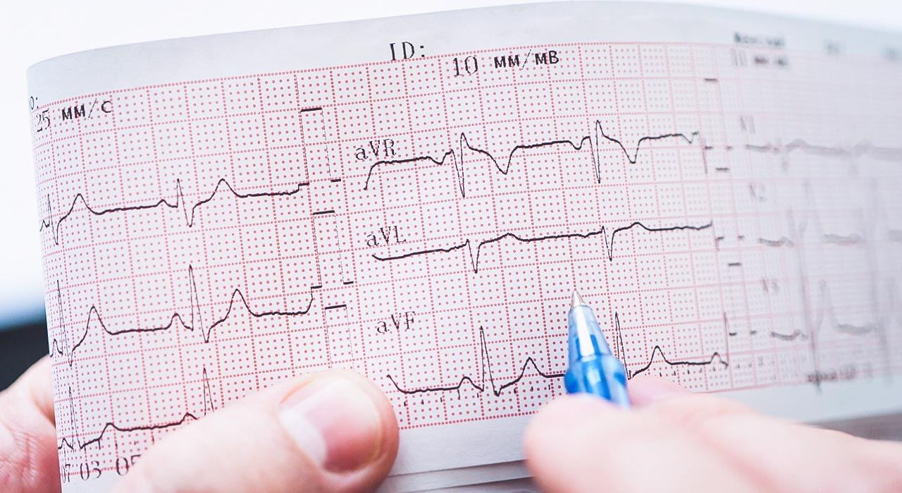 Ile kosztuje badanie EKG w 2024 roku i dlaczego warto je wykonać?